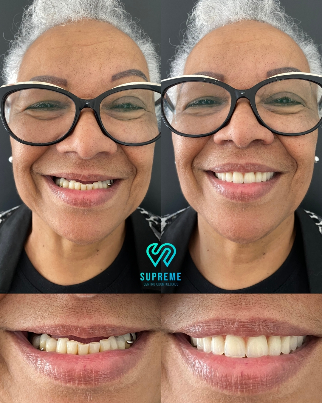 Antes e depois — caso 2
