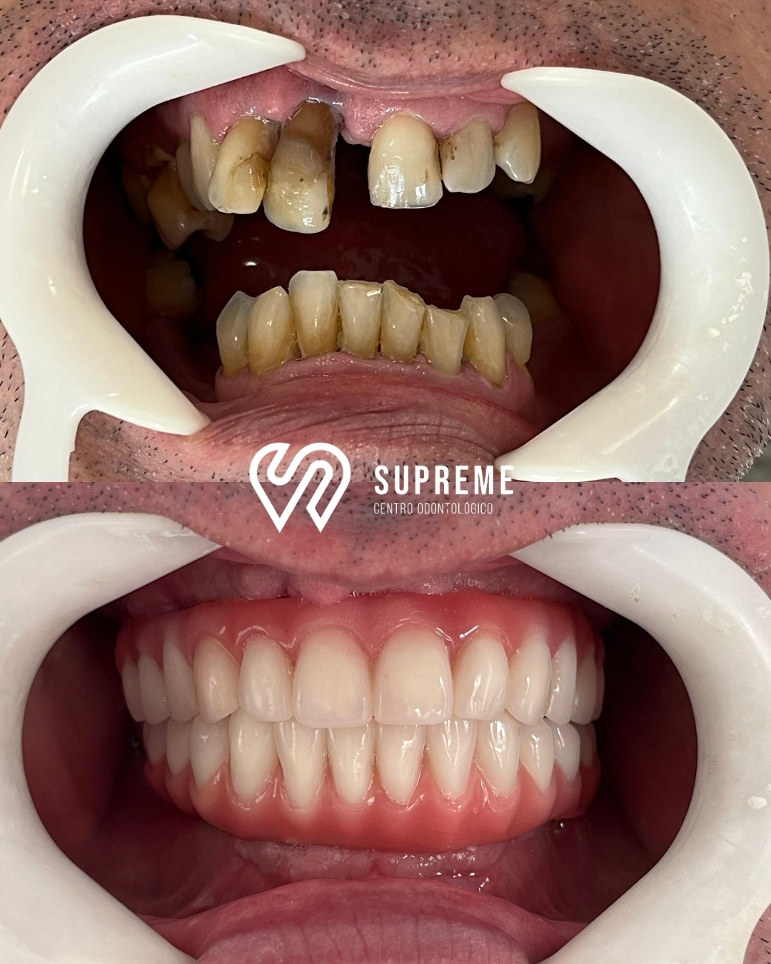Antes e depois — caso 3