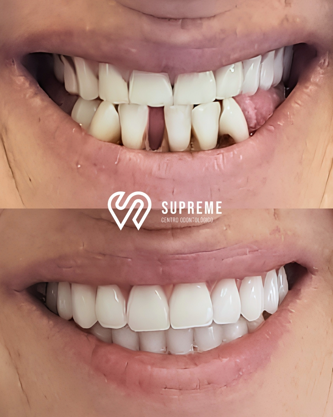 Antes e depois — caso 4